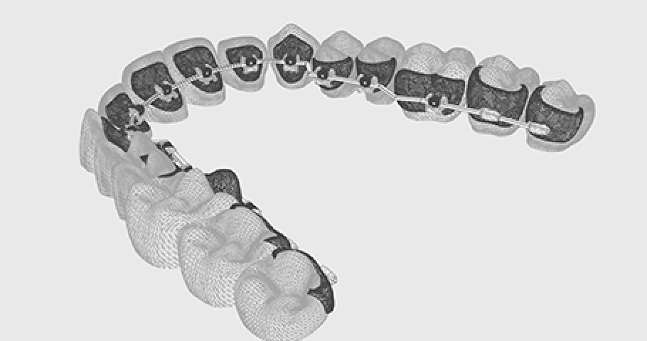 歯列の図