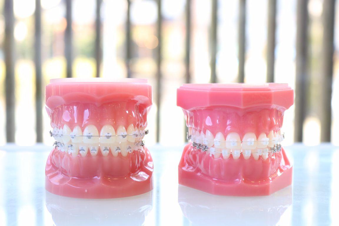 二つの歯の模型