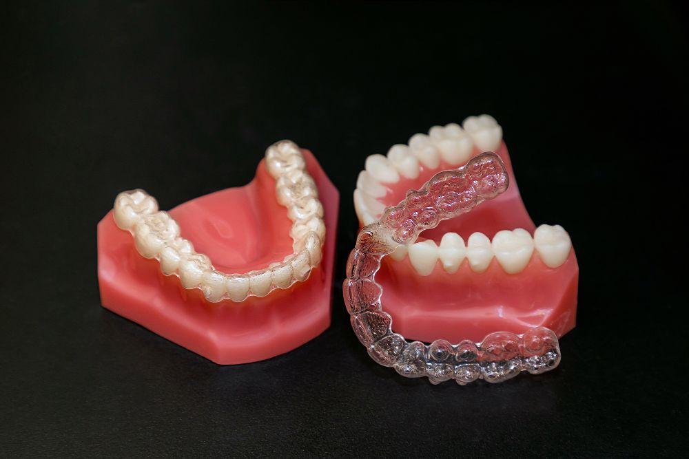 歯の模型と透明のマウスピース