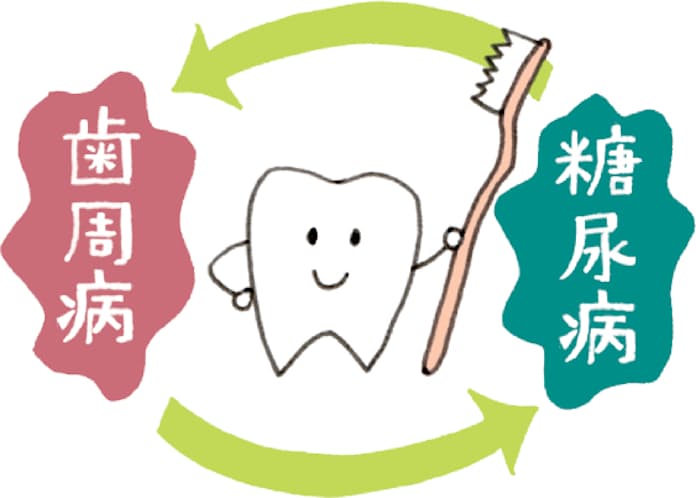 歯周病と糖尿病の関係