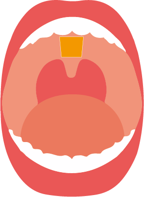 舌力アップのトレーニング